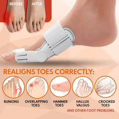 Pain Relief Bunion Toe Corrector - (IMPORTED)