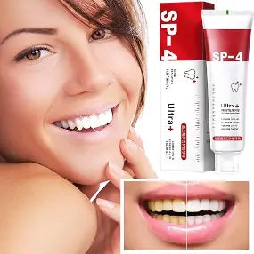 SP-4 Ultra White Probiotic Paste